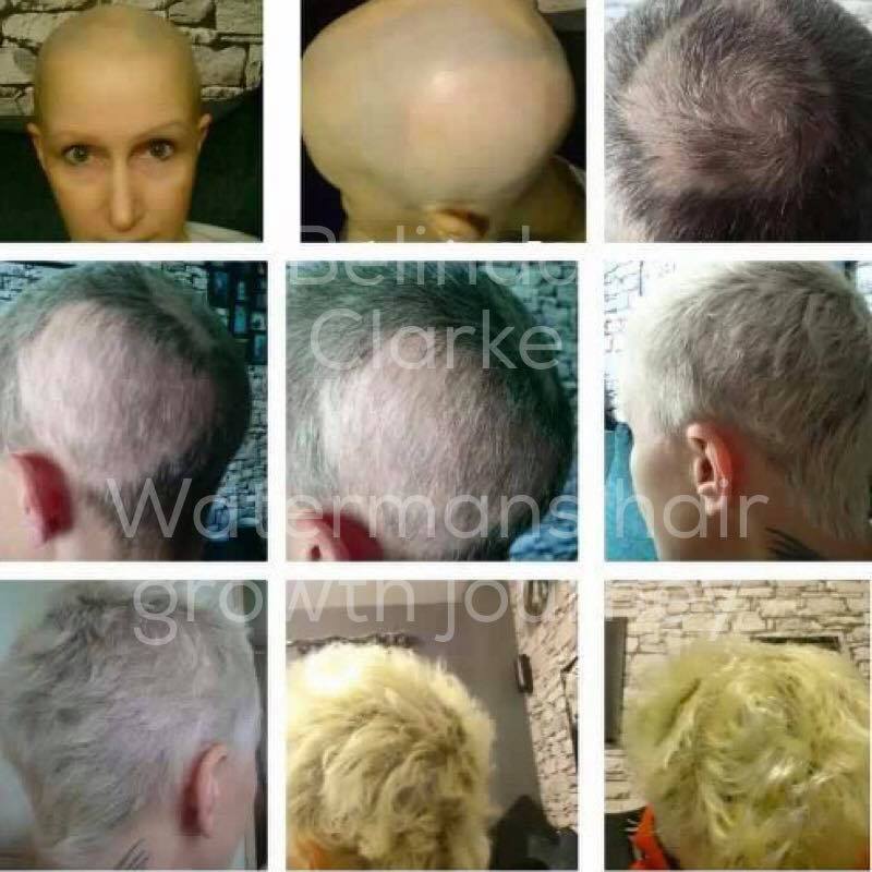 shampoo for alopecia 