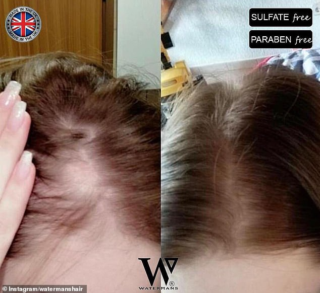 Grow Me® Hair loss Shampoo & Conditioner Set - Boost your hair growth rate